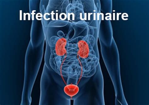 méat urinaire|Les douleurs à l’urètre chez l’homme